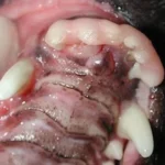 Paciente canino após redução da fratura e imobilização com resina (como se fosse um gesso sobre os dentes).
